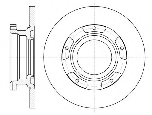 REMSA 61107.00